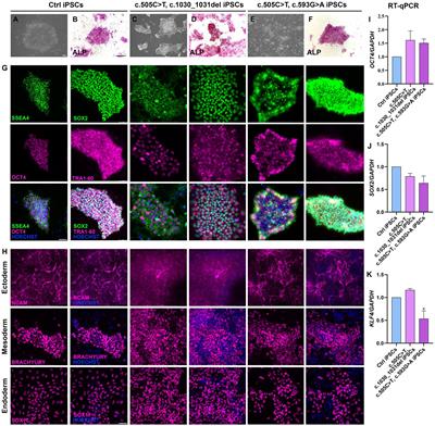 Modeling riboflavin transporter deficiency type 2: from iPSC-derived motoneurons to iPSC-derived astrocytes
